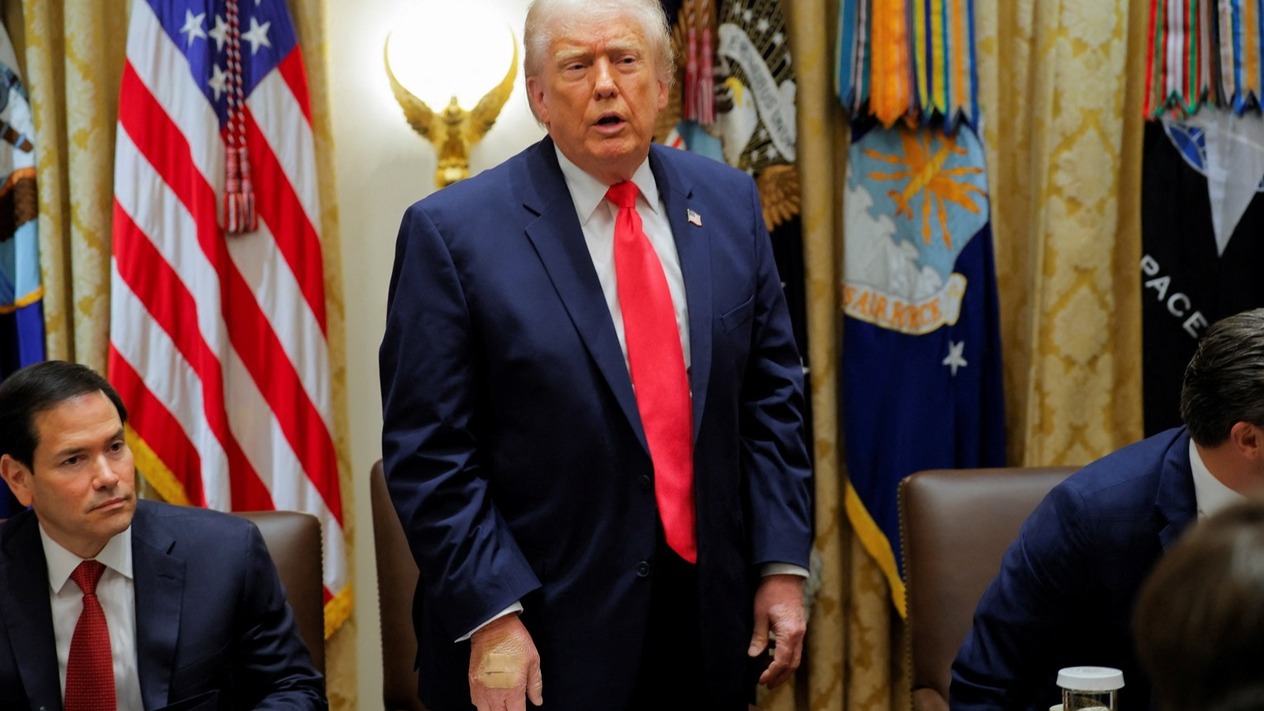 ABD Başkanı Trump’ın eli neden bandajlı?