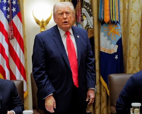 ABD Başkanı Trump’ın eli neden bandajlı?