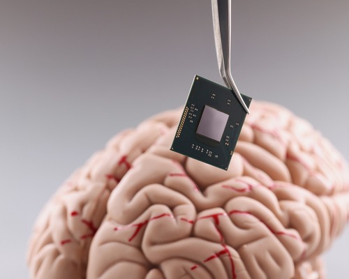 Çin’in beyin implantı girişimleri Musk’ın Neuralink’ine rakip oluyor