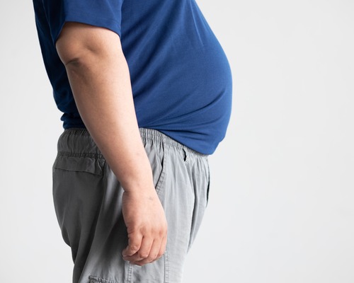 Obezite tedavisinde sigorta dönemi