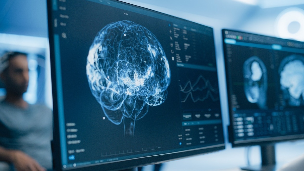 Yaklaşık dört bin kişi izlendi: Beyin hangi yaşlarda değişiyor?